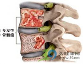 九旬隐睾如何面对癌症