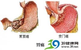 我是得了癌症才变得长寿