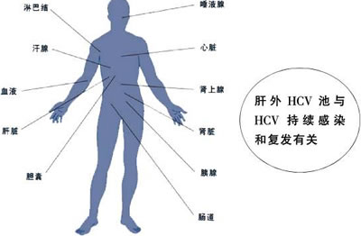 丙型肝炎治疗的复发危险因素分析